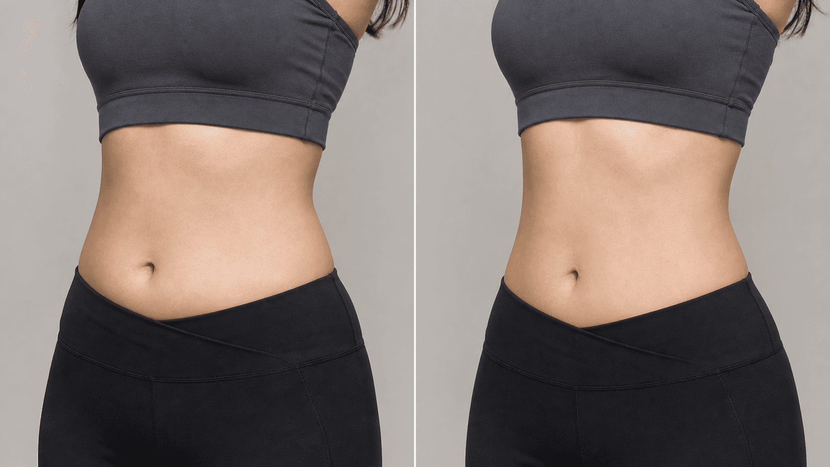 AI-generated reference image for Body slimming injection