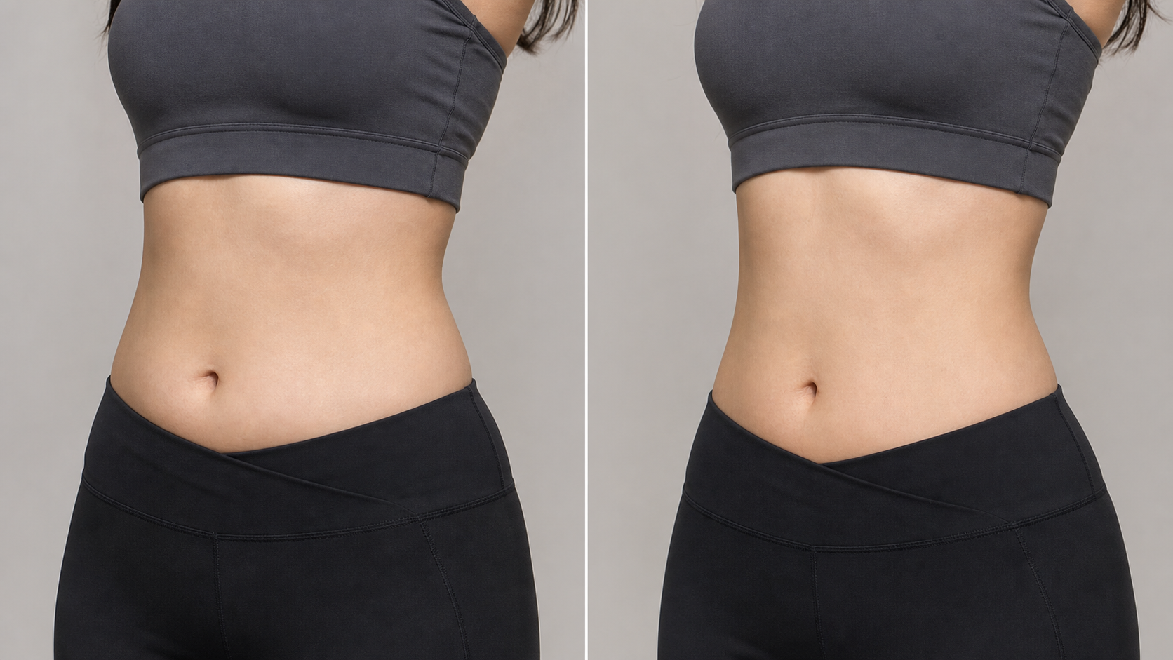 Body slimming injection near Sinpung Station | Antone Clinic